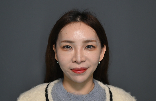 過去總習慣為他人而活，忘了把自己擺在第一順位」｜見證案例-安夏Mika